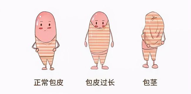 儿童包皮一定要切吗,雷火平台
